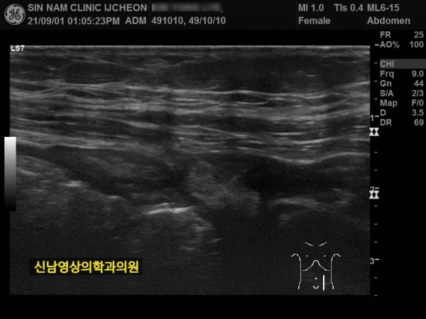 0ac7375d2de753c51699b4acef1b4092_1758768